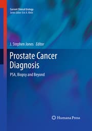 Cover von Prostate Cancer Diagnosis