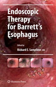 Cover von Endoscopic Therapy for Barrett's Esophagus