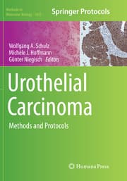 Cover von Urothelial Carcinoma