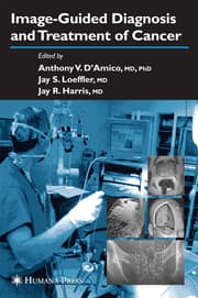 Cover von Image-Guided Diagnosis and Treatment of Cancer
