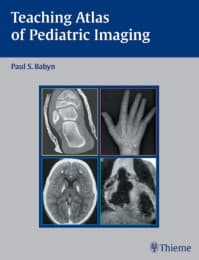 Cover von Teaching Atlas of Pediatric Imaging