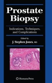 Cover von Prostate Biopsy