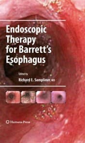 Cover von Endoscopic Therapy for Barrett's Esophagus