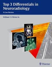 Cover von Top 3 Differentials in Neuroradiology