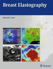 Cover von Breast Elastography