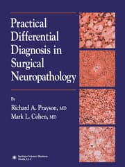 Cover von Practical Differential Diagnosis in Surgical Neuropathology