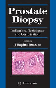 Cover von Prostate Biopsy