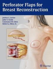 Cover von Perforator Flaps for Breast Reconstruction