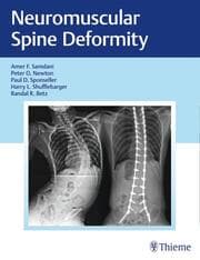 Cover von Neuromuscular Spine Deformity
