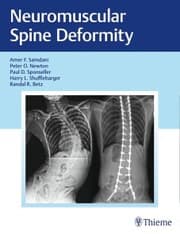 Cover von Neuromuscular Spine Deformity