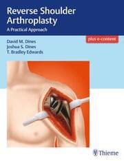 Cover von Reverse Shoulder Arthroplasty