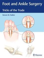 Cover von Foot and Ankle Surgery