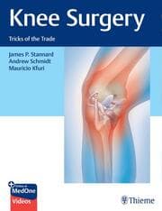 Cover von Knee Surgery