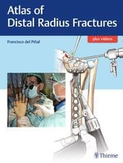 Cover von Atlas of Distal Radius Fractures