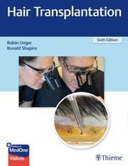 Cover von Hair Transplantation