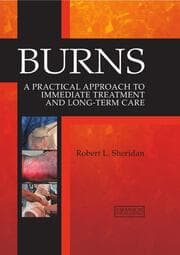 Cover von Burns