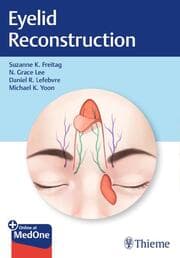 Cover von Eyelid Reconstruction