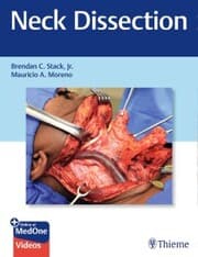 Cover von Neck Dissection