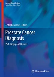 Cover von Prostate Cancer Diagnosis