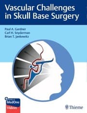 Cover von Vascular Challenges in Skull Base Surgery