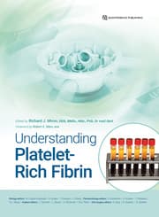 Cover von Understanding Platelet-Rich Fibrin