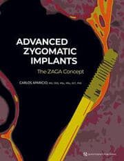 Cover von Advanced Zygomatic Implants