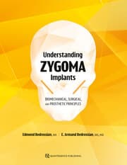 Cover von Understanding Zygoma Implants