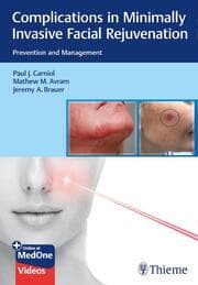 Cover von Complications in Minimally Invasive Facial Rejuvenation