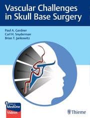 Cover von Vascular Challenges in Skull Base Surgery