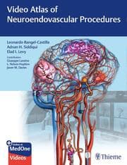 Cover von Video Atlas of Neuroendovascular Procedures