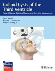Cover von Colloid Cysts of the Third Ventricle