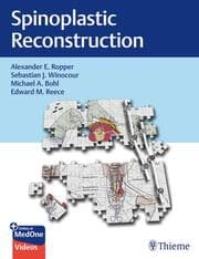 Cover von Spinoplastic Reconstruction