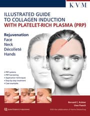 Cover von Illustrated Guide to Collagen Induction with Platelet-Rich Plasma (PRP)/Bildatlas Kollageninduktion mit Platelet Rich Plasma (PRP)