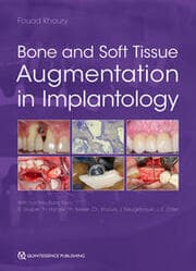 Cover von Bone and Soft Tissue Augmentation in Implantology