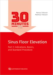 Cover von 30 Minutes to Sinus Floor Elevation
