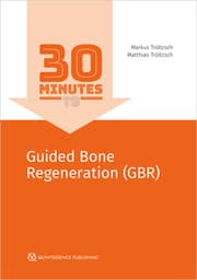 Cover von 30 Minutes to Guided Bone Regeneration (GBR)