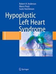 Cover von Hypoplastic Left Heart Syndrome