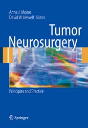 Cover von Tumor Neurosurgery