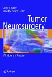 Cover von Tumor Neurosurgery
