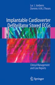 Cover von Implantable Cardioverter Defibrillator Stored ECGs