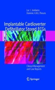 Cover von Implantable Cardioverter Defibrillator Stored ECGs
