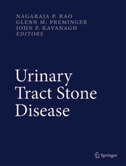 Cover von Urinary Tract Stone Disease