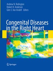 Cover von Congenital Diseases in the Right Heart