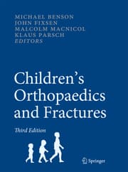 Cover von Childrens Orthopaedics and Fractures