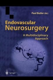 Cover von Endovascular Neurosurgery