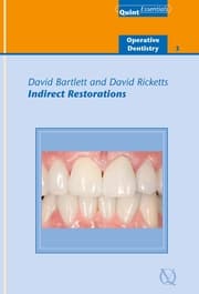 Cover von Indirect Restorations