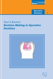 Cover von Decision-Making in Operative Dentistry