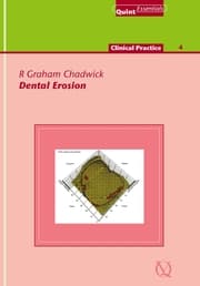 Cover von Dental Erosion