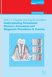 Cover von Understanding Periodontal Diseases: Assessment and Diagnostic Procedures in Practice