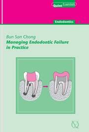Cover von Managing Endodontic Failure in Practice
